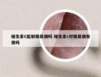 维生素C能制银屑病吗 维生素c对银屑病有用吗