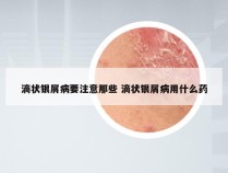 滴状银屑病要注意那些 滴状银屑病用什么药