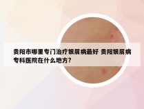 贵阳市哪里专门治疗银屑病最好 贵阳银屑病专科医院在什么地方?