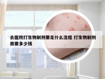 去医院打生物制剂要走什么流程 打生物制剂需要多少钱