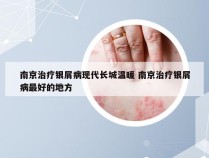南京治疗银屑病现代长城温暖 南京治疗银屑病最好的地方