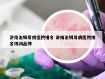 济南治银屑病医院排名 济南治银屑病医院排名博润品牌