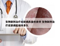 生物制剂治疗皮肤病具备的条伴 生物制剂治疗皮肤病能维持多久