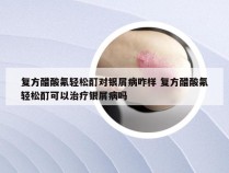复方醋酸氟轻松酊对银屑病咋样 复方醋酸氟轻松酊可以治疗银屑病吗