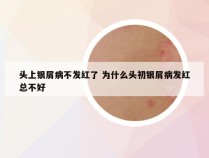 头上银屑病不发红了 为什么头初银屑病发红总不好