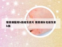 银屑病服用b族维生素片 银屑病补充维生素b族