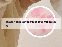 拉萨哪个医院治疗牛皮癣好 拉萨皮肤专科医院