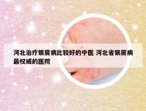 河北治疗银屑病比较好的中医 河北省银屑病最权威的医院