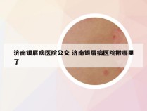 济南银屑病医院公交 济南银屑病医院搬哪里了