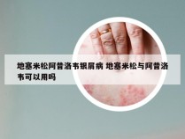 地塞米松阿昔洛韦银屑病 地塞米松与阿昔洛韦可以用吗