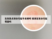 左氧氟点滴会引起牛皮癣吗 输液左氧会引起霉菌吗