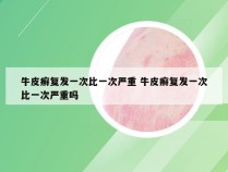 牛皮癣复发一次比一次严重 牛皮癣复发一次比一次严重吗