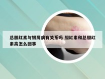 总胆红素与银屑病有关系吗 胆红素和总胆红素高怎么回事