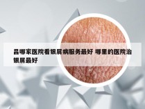 昌哪家医院看银屑病服务最好 哪里的医院治银屑最好