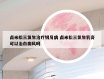 卤米松三氯生治疗银屑病 卤米松三氯生乳膏可以治白癜风吗