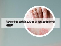在河南省银屑病怎么报销 河南银屑病治疗最好医院