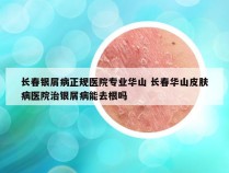 长春银屑病正规医院专业华山 长春华山皮肤病医院治银屑病能去根吗