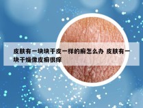 皮肤有一块块干皮一样的癣怎么办 皮肤有一块干燥像皮癣很痒