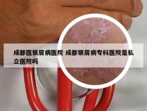 成都医银屑病医院 成都银屑病专科医院是私立医院吗