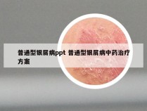 普通型银屑病ppt 普通型银屑病中药治疗方案