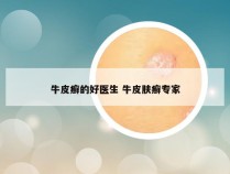 牛皮癣的好医生 牛皮肤癣专家