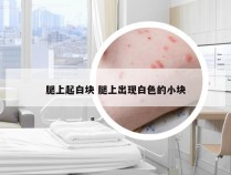 腿上起白块 腿上出现白色的小块