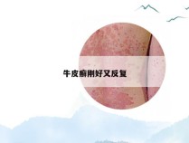 牛皮癣刚好又反复