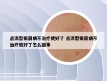 点滴型银屑病不治疗就好了 点滴型银屑病不治疗就好了怎么回事