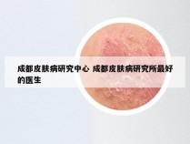 成都皮肤病研究中心 成都皮肤病研究所最好的医生
