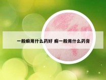 一般癣用什么药好 癣一般用什么药膏