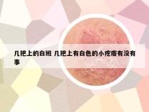 几把上的白班 几把上有白色的小疙瘩有没有事