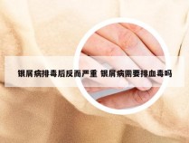 银屑病排毒后反而严重 银屑病需要排血毒吗