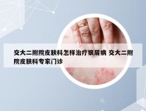 交大二附院皮肤科怎样治疗银屑病 交大二附院皮肤科专家门诊