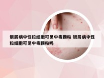 银屑病中性粒细胞可见中毒颗粒 银屑病中性粒细胞可见中毒颗粒吗