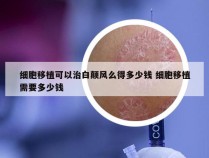 细胞移植可以治白颠风么得多少钱 细胞移植需要多少钱