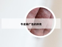 牛皮癣广告的种类