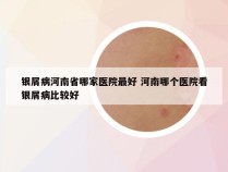 银屑病河南省哪家医院最好 河南哪个医院看银屑病比较好