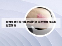 郑州哪里可以打生物制剂针 郑州哪里可以打北京生物