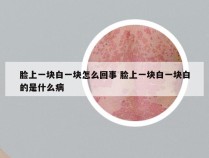 脸上一块白一块怎么回事 脸上一块白一块白的是什么病