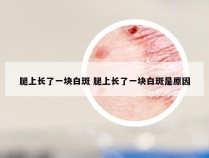 腿上长了一块白斑 腿上长了一块白斑是原因