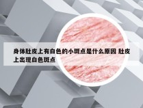 身体肚皮上有白色的小斑点是什么原因 肚皮上出现白色斑点