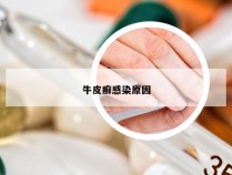 牛皮癣感染原因