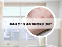 癣毒净怎么样 毒癣净抑菌乳膏说明书