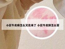 小区牛皮癣怎么又出来了 小区牛皮鲜怎么管