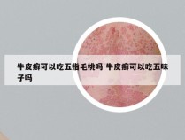 牛皮癣可以吃五指毛桃吗 牛皮癣可以吃五味子吗
