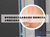 春季银屑病吃什么水果会更好 银屑病吃什么水果提高免疫力