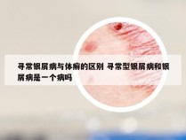 寻常银屑病与体癣的区别 寻常型银屑病和银屑病是一个病吗