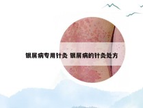 银屑病专用针灸 银屑病的针灸处方