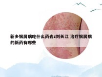 新乡银屑病吃什么药去z刘长江 治疗银屑病的新药有哪些