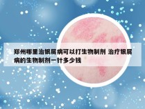 郑州哪里治银屑病可以打生物制剂 治疗银屑病的生物制剂一针多少钱